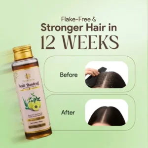 anti dandruff hair oil